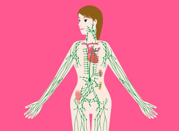 Breast cancer and lymphoedema – Thompsons Road Physiotherapy